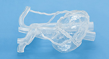CABGモデル