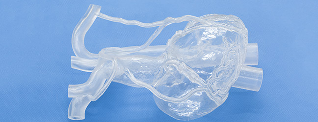 CABGモデル