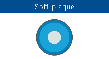 Soft plaque