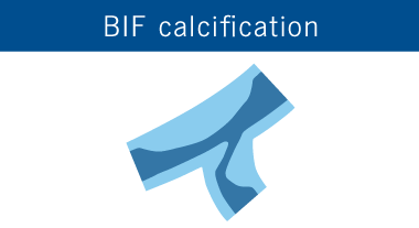 BIF calcification